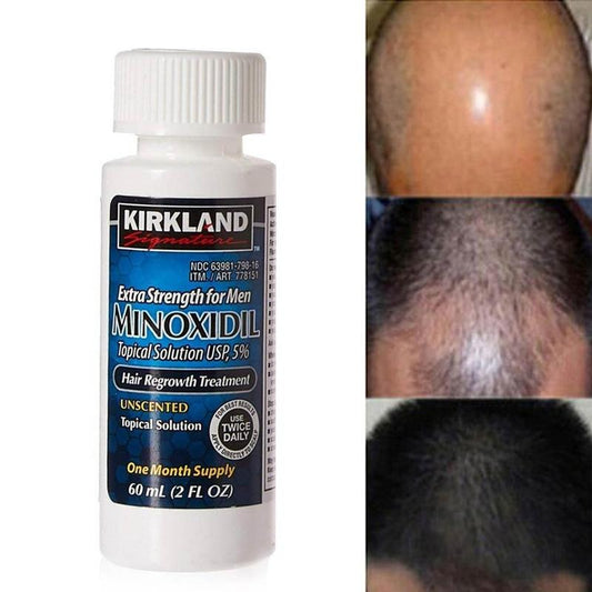 Minoxidil Original para Crecimiento del Cabello