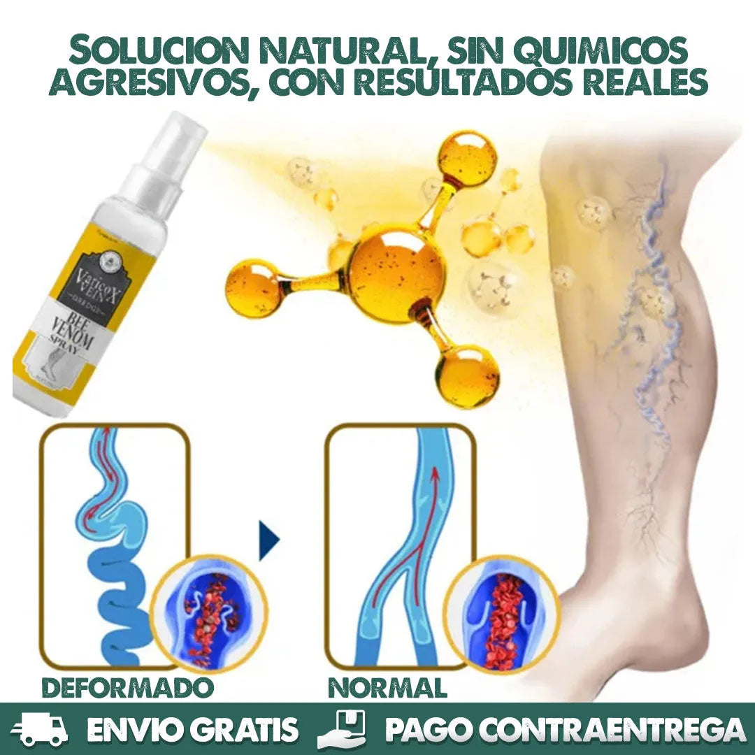 VARlC0X™ Spray para reducir venas varices