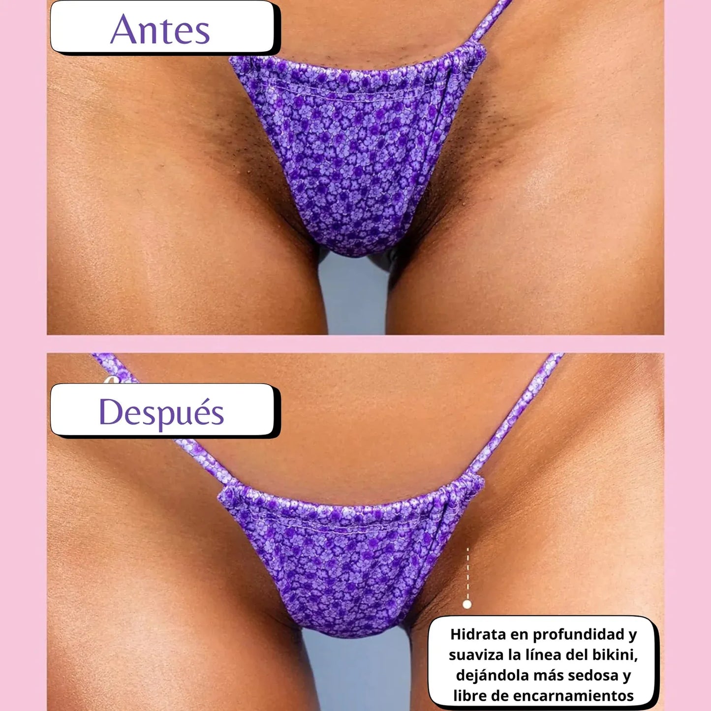 Combo Suavidad Total Post-Depilación Truly