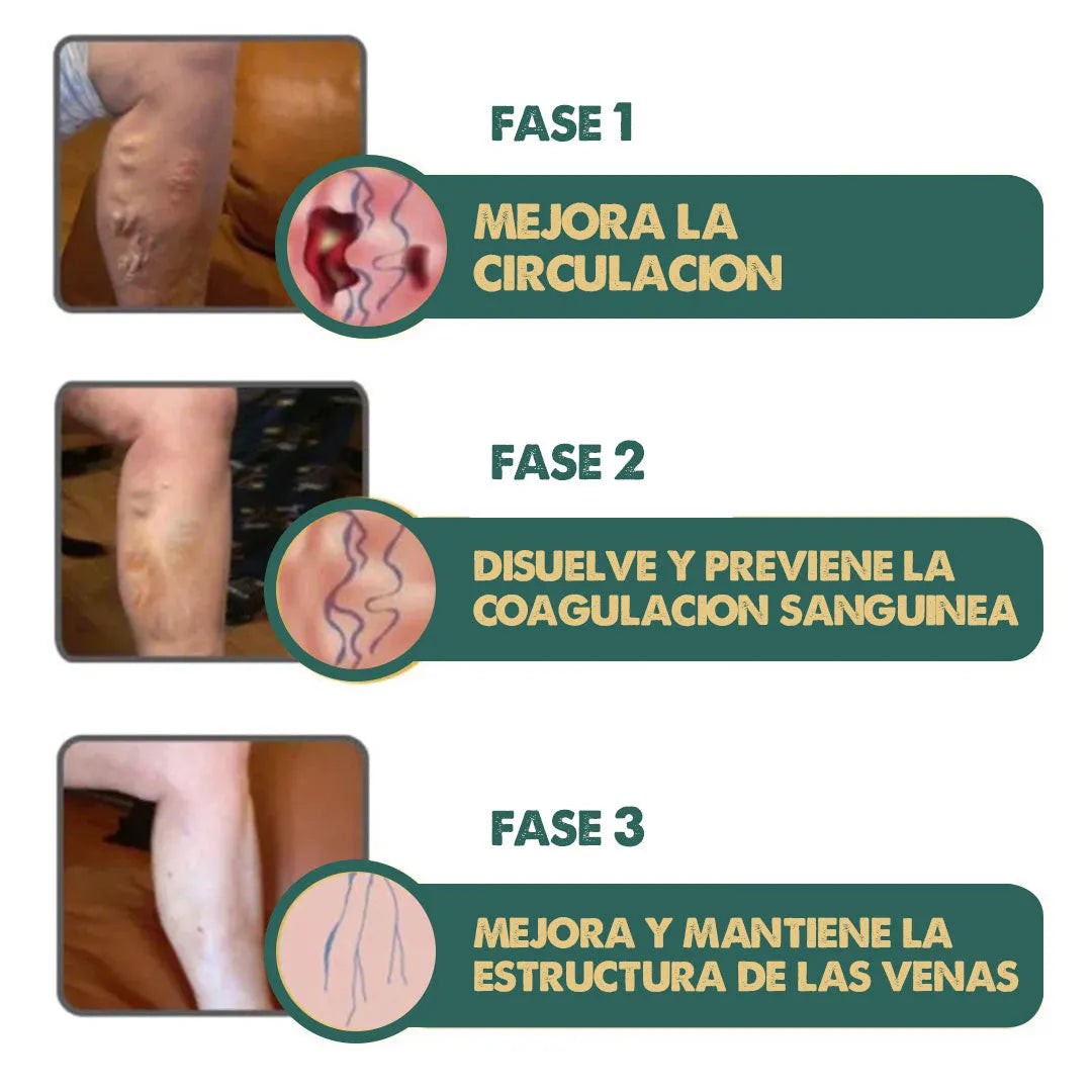 VARlC0X™ Spray para reducir venas varices